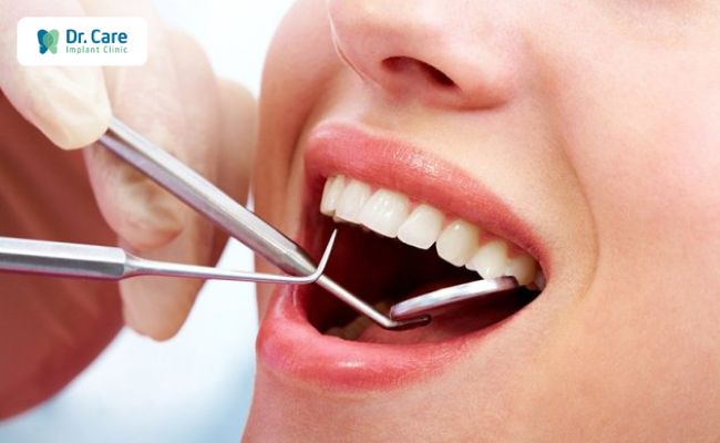 Cách khắc phục triệt để tình trạng bọc răng sứ bị hở