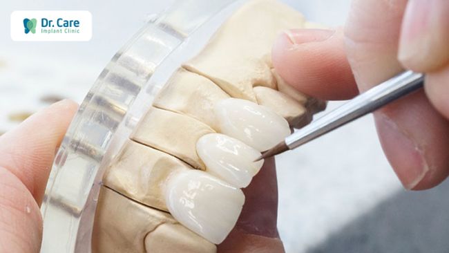 Bước 3: Gây tê, mài cùi răng, lấy dấu răng sứ và gắn răng giả tạm thời.