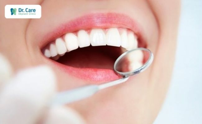 Răng sứ kim loại có giá bao nhiêu?