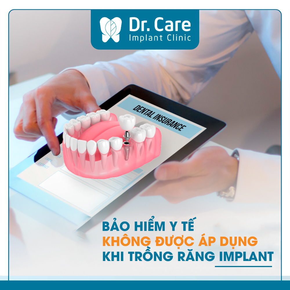 Trồng răng Implant có được bảo hiểm không?