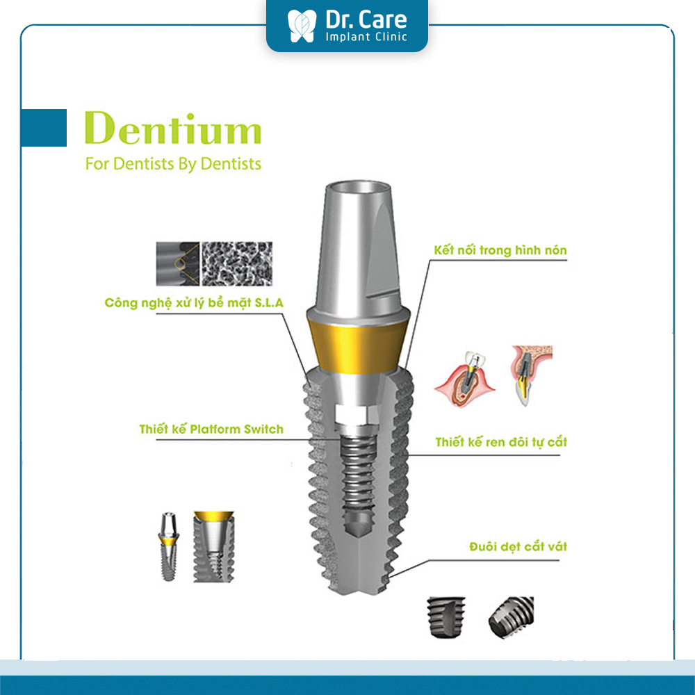 Cấu tạo trụ Implant Dentium Hàn Quốc