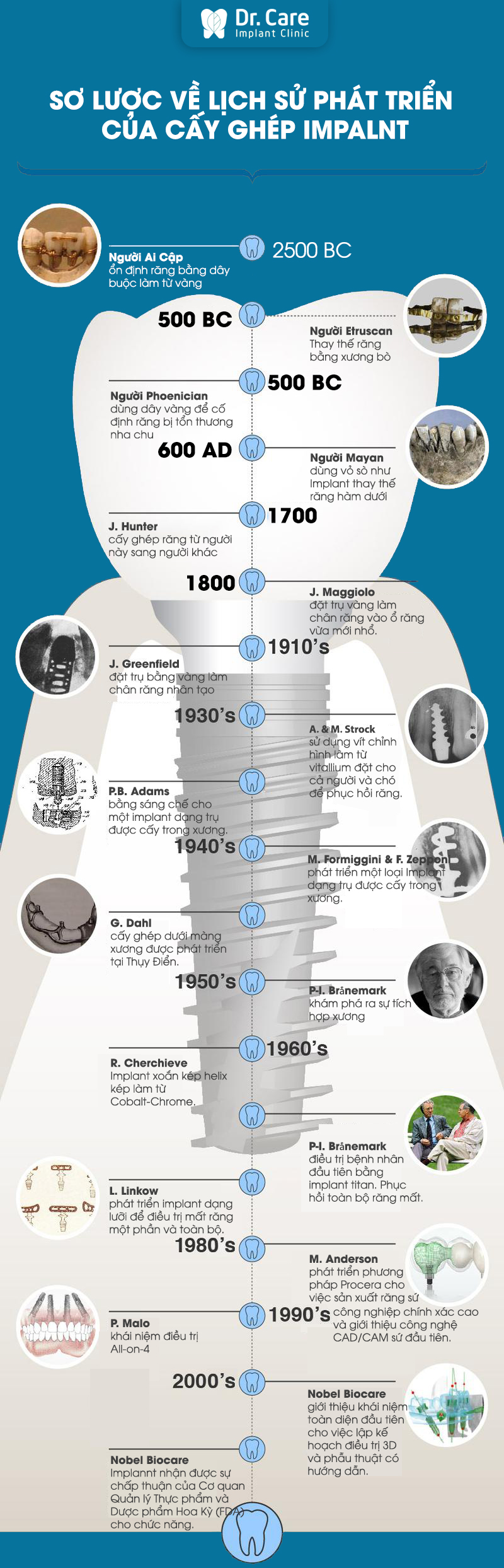 Lịch sử hình thành phương pháp cấy ghép Implant?