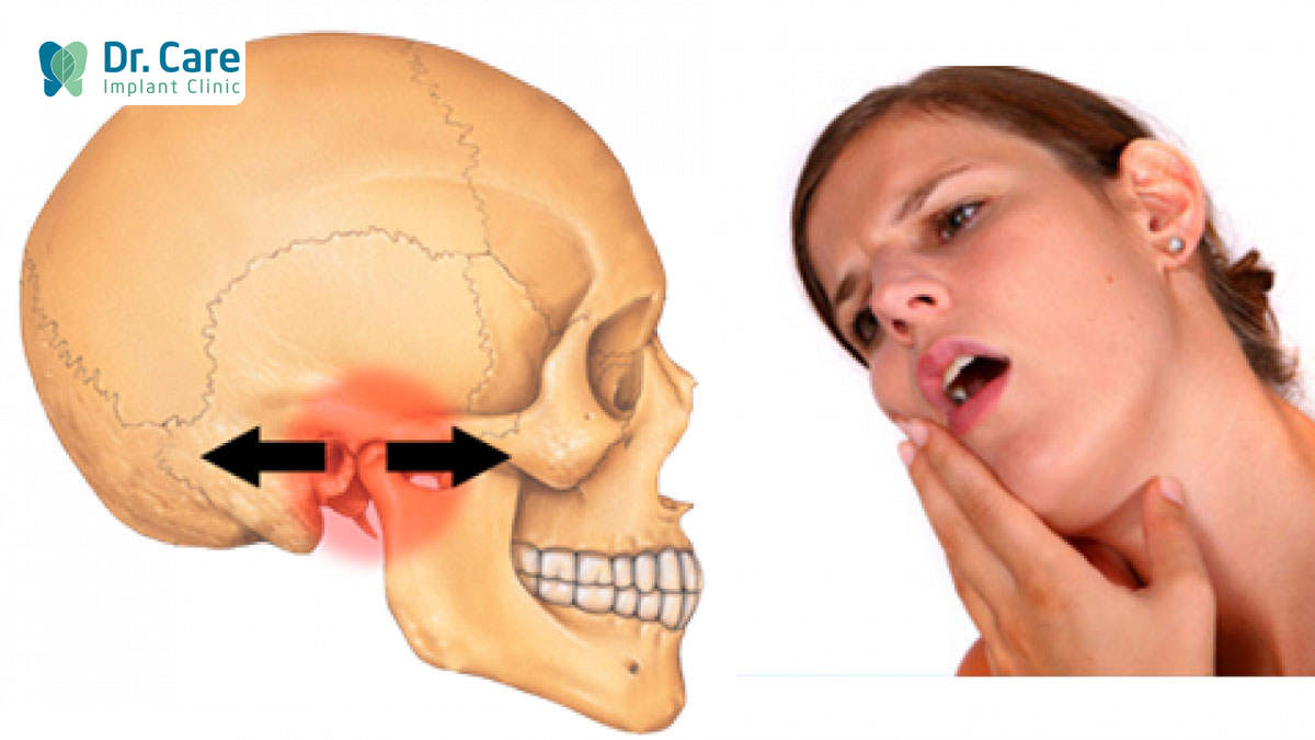 Nguyên nhân của đau quai hàm