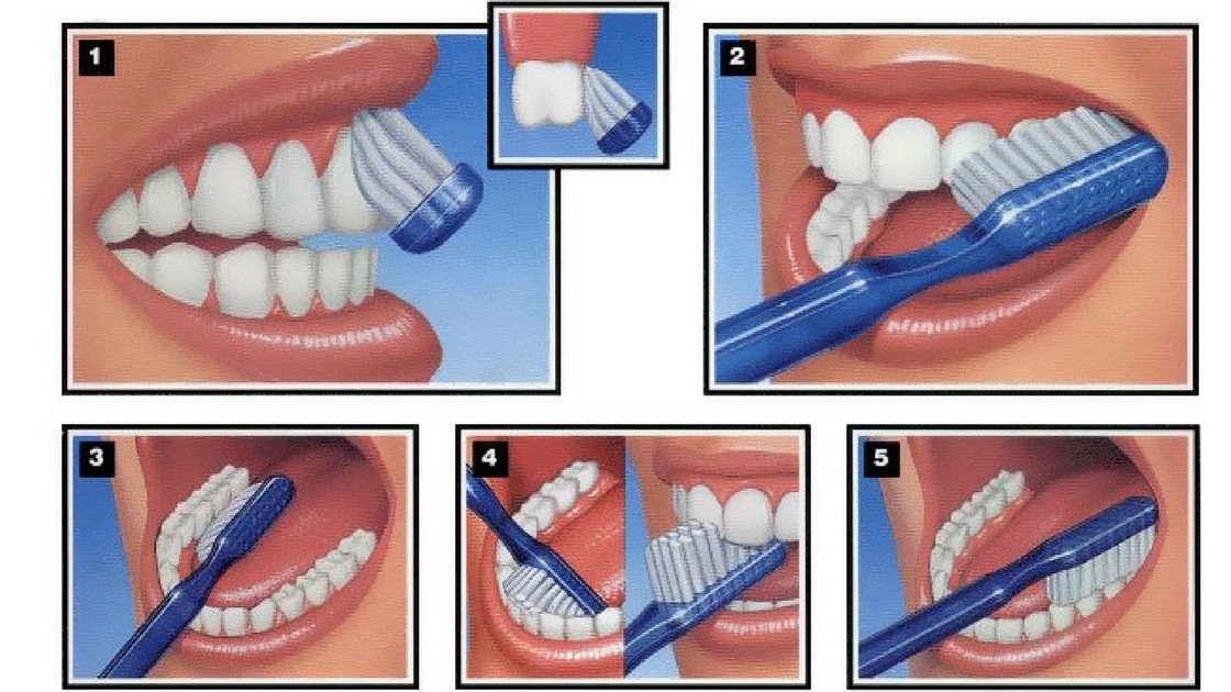 Hướng dẫn cách chải răng đúng cách theo khoa học