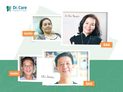Hơn 1.500 Khách hàng đã lựa chọn trồng răng Implant thành công tại nha khoa Dr. Care