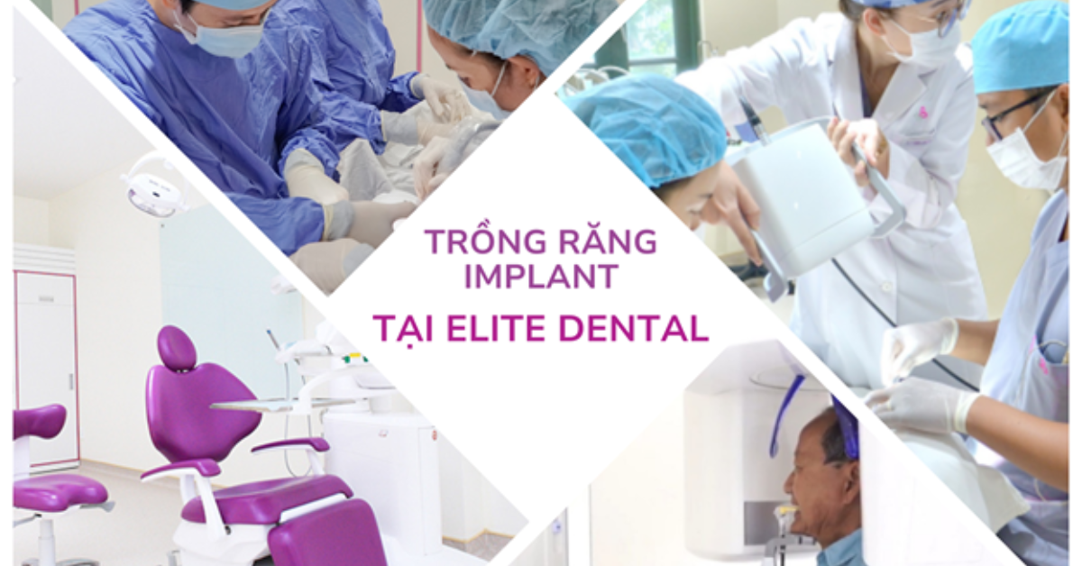 Nha khoa Elite – Trung tâm Implant và Phục hình kỹ thuật số tại TP.HCM