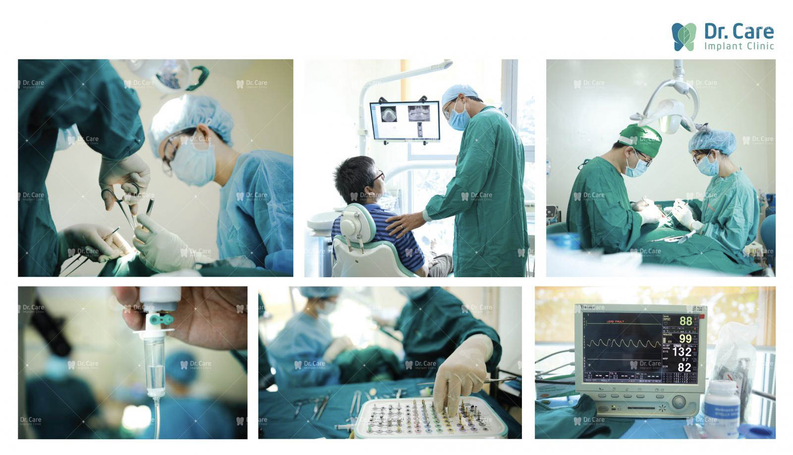 Ứng dụng công nghệ cấy ghép Implant hiện đại