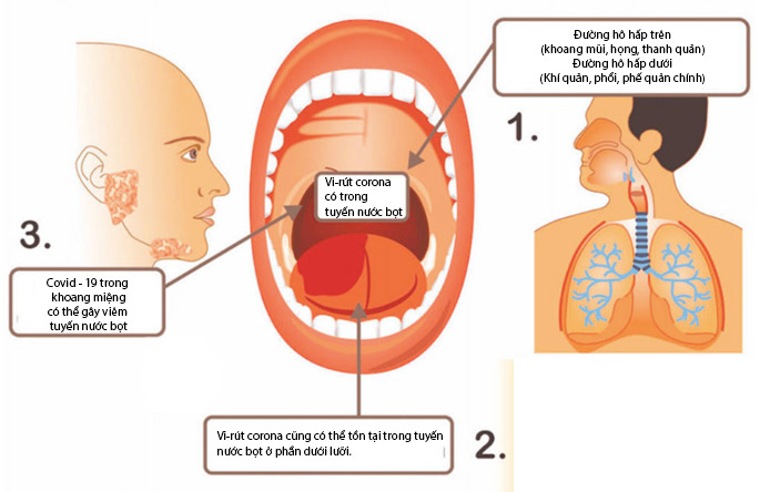 Sử dụng nước súc miệng ở Khoang miệng, vùng hầu họng để chặn  “cửa ngõ” đầu tiên của vi-rút corona trước khi xâm nhập vào cơ thể.