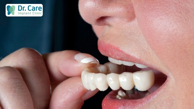 Răng giả tạm thời là gì?