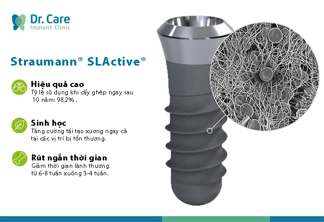 Implant Straumann (Thụy Sĩ)