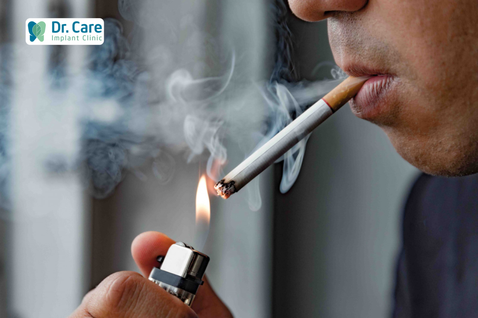 Hút thuốc lá làm tăng nguy cơ mắc các bệnh ung thư nướu