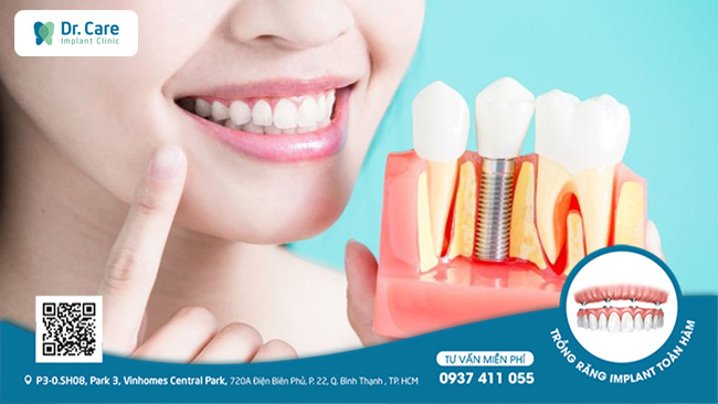 Để đảm bảo được tính an toàn và chính xác, thông thường Bác sĩ sẽ đưa ra lời khuyên là nên thực hiện phương pháp chỉnh nha trước khi trồng răng implant