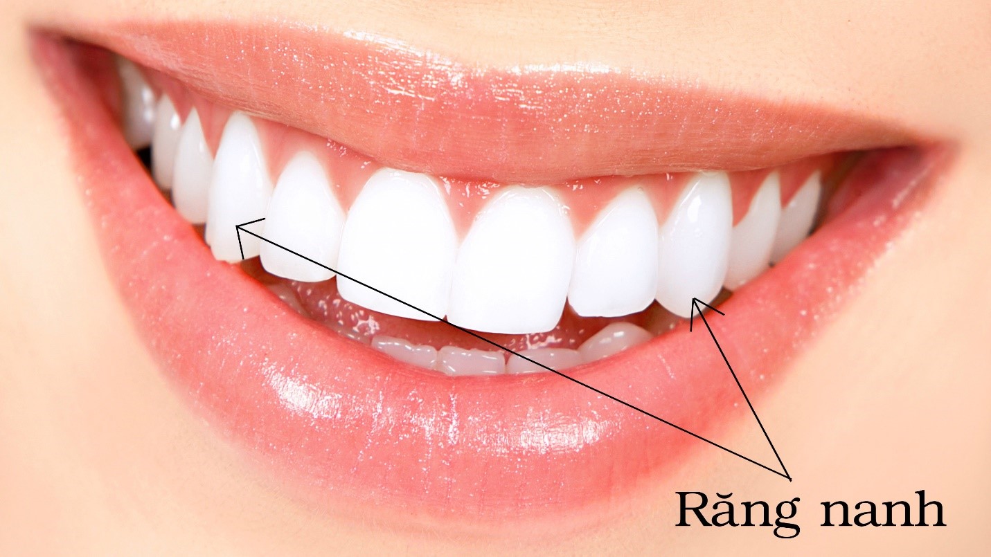 Trồng răng nanh bao nhiêu tiền và phương pháp nào tốt nhất? 