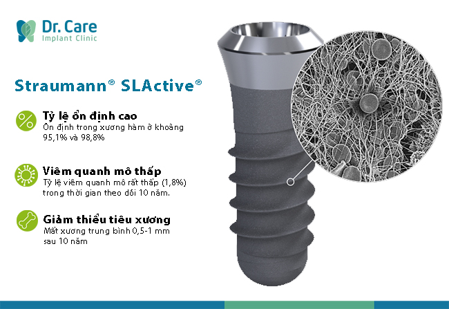 So sánh ưu điểm và nhược điểm của Implant Straumann SLA và Straumann SLActive