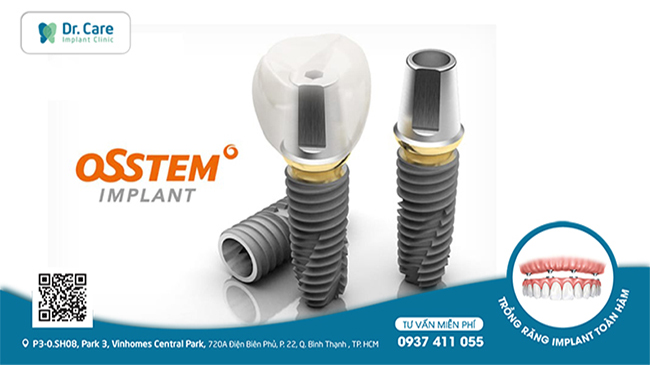 Trụ Implant Osstem Implant có khả năng tích hợp với xương hàm nhanh