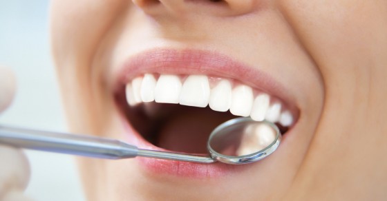 Quá trình điều trị trồng răng sứ và cấy ghép implant có khác nhau không?

