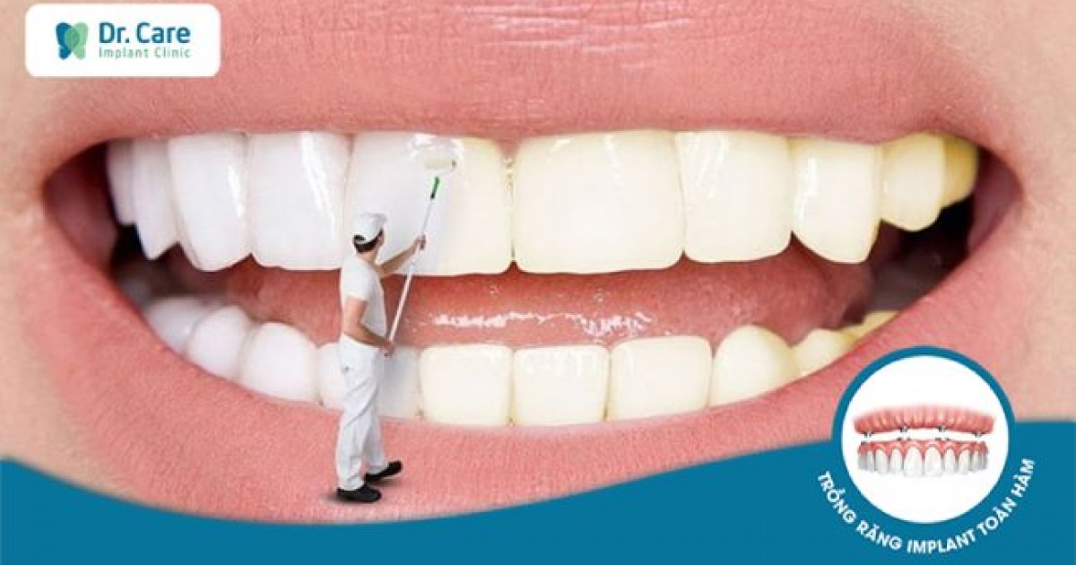 Có những phương pháp tự nhiên nào để làm trắng răng sứ?
