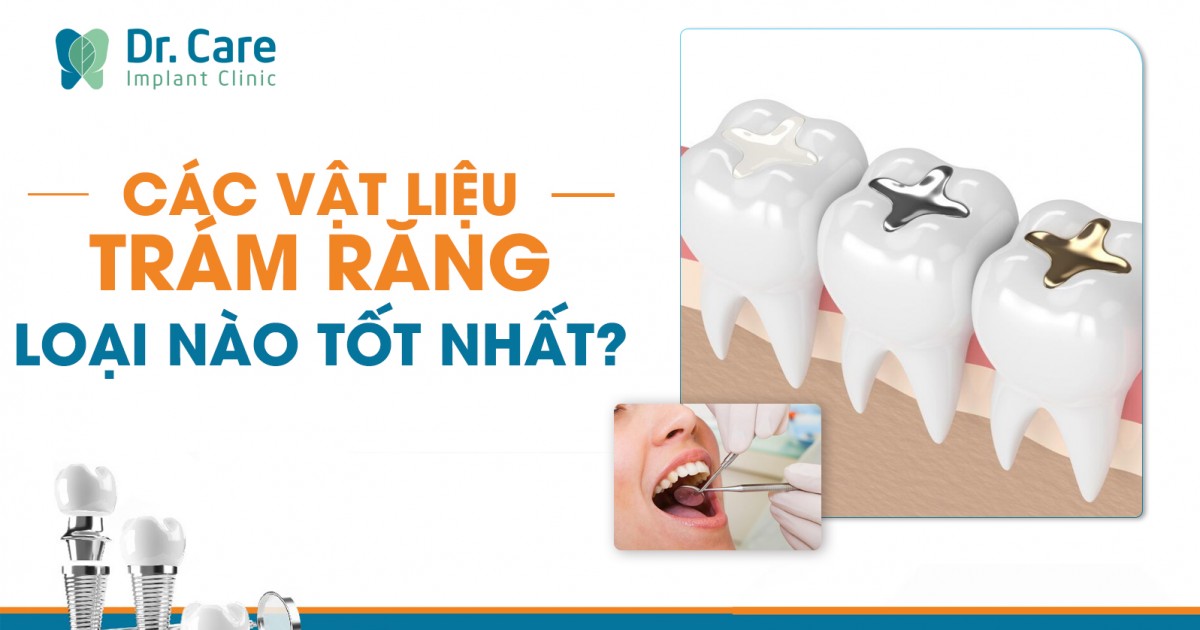 4. Lựa Chọn Loại Trám Phù Hợp