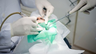 Trồng răng Implant (cấy ghép Implant) mất bao lâu?