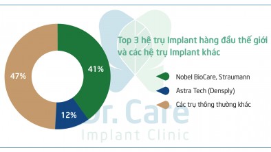 Top 10 dòng trụ Implant phổ biến nhất hiện nay
