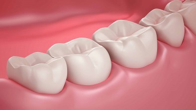 Mất răng hàm có thể cấy ghép Implant được không? 