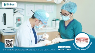 Cấy ghép Implant là gì? Những lưu ý khi cấy ghép Implant