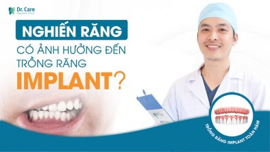 Nghiến răng và những lưu ý khi trồng răng Implant