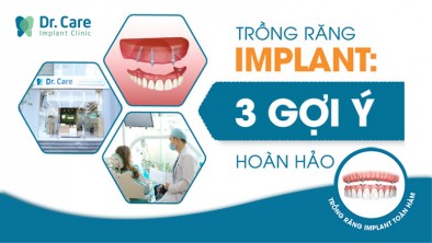 3 gợi ý quan trọng cho người trung niên khi chọn nha khoa trồng răng Implant