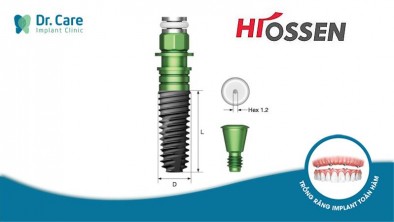 Trụ Implant Hiossen - Tìm hiểu xuất xứ, ưu điểm và giá cả