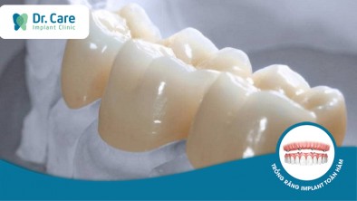 Răng sứ Zirconia là gì? Ưu điểm, hạn chế và giá cả
