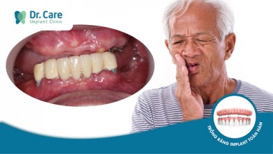 7 Nguy hiểm phải đối mặt khi mất răng toàn hàm