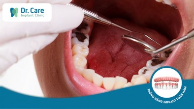 [CẨN TRỌNG] 6 dấu hiệu nhiễm trùng sau khi nhổ răng