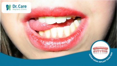 Răng cắn lưỡi: 6 bệnh bệnh lý nguy hiểm về não, răng miệng