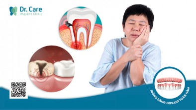 [TỔNG QUAN]: Đau răng và những biến chứng cần biết