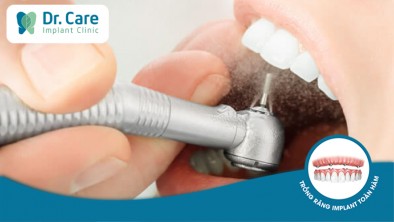 Mài răng có đau không? Mài răng bọc sứ ảnh hưởng gì?