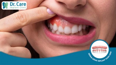 Bọc răng sứ bị đau nướu có gây nguy hiểm không?