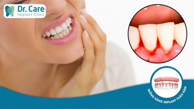 Đau răng dẫn đến chảy máu chân răng có nguy hiểm không?