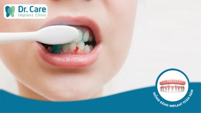 Vì sao lại bị chảy máu nướu răng khi đánh răng?