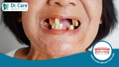 Dấu hiệu răng miệng của tuổi già và những bệnh cần phải lưu ý