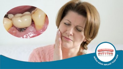 Bị đau sau khi trồng răng Implant phải làm gì để giảm đau?