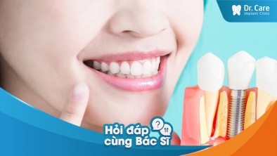 Tôi đã mất răng lâu năm và cảm thấy mất tự tin. Liệu trụ Implant Hàn Quốc có thể giúp tôi khôi phục lại nụ cười không?