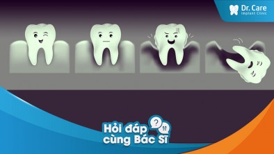 Bệnh nha chu có nguy hiểm không? Giai đoạn nào ảnh hưởng đến tình trạng mất răng?