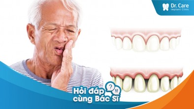 Răng bị lung lay do viêm nha chu có nguy hiểm không?