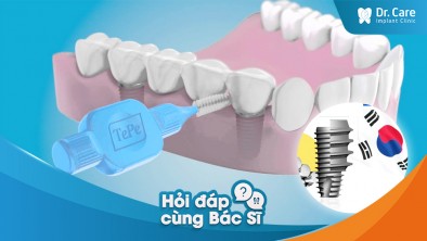Cách vệ sinh răng miệng sau khi trồng trụ Implant Hàn Quốc?