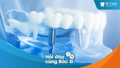 Sử dụng chất kích thích sau khi cắm trụ Implant có bị đau răng không?