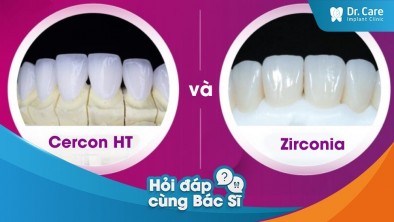 So sánh mức chi phí giữa răng sứ Zirconia và răng sứ Cercon HT?