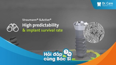 Những trụ Implant nào có công nghệ xử lý bề mặt tốt nhất hiện nay?