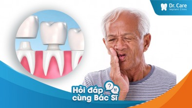 Mất răng sau khi làm cầu răng sứ tác động đến chất lượng cuộc sống như thế nào?