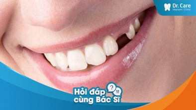 Mất răng số 3 có trồng răng sứ cố định được không?