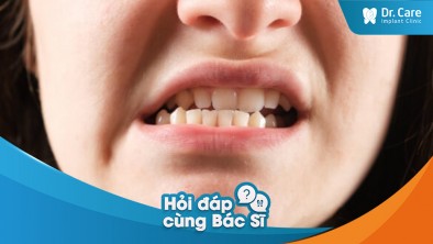 Cầu răng sứ bị hở và gây ra tình trạng lệch khớp cắn có nguy hiểm không?
